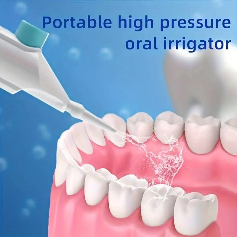 Portable High-Pressure Oral Irrigator – Water Floss & Teeth Cleaner